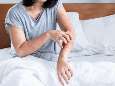 donna che si gratta per punture cimici da letto