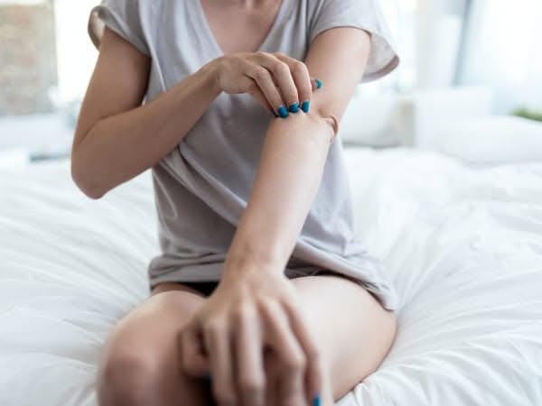 una donna si gratta per le punture delle cimici da letto